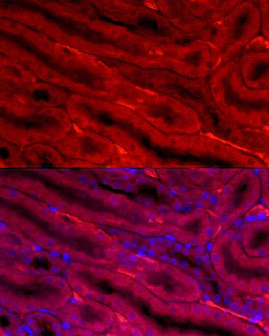 BBOX1 Antibody in Immunocytochemistry (ICC/IF)