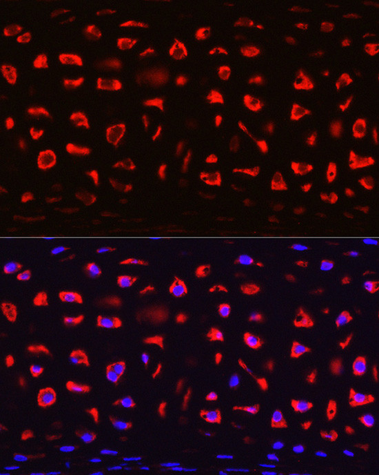 COMP Antibody in Immunohistochemistry (Paraffin) (IHC (P))