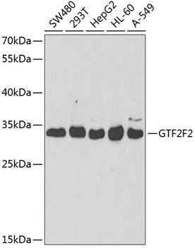 GTF2F2 Antibody in Western Blot (WB)