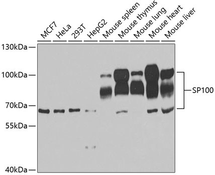 SP100 Antibody in Western Blot (WB)