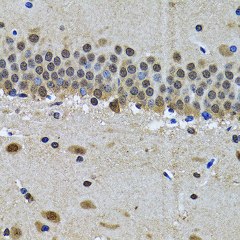 SPIN1 Antibody in Immunohistochemistry (Paraffin) (IHC (P))