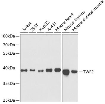 TWF2 Antibody in Western Blot (WB)