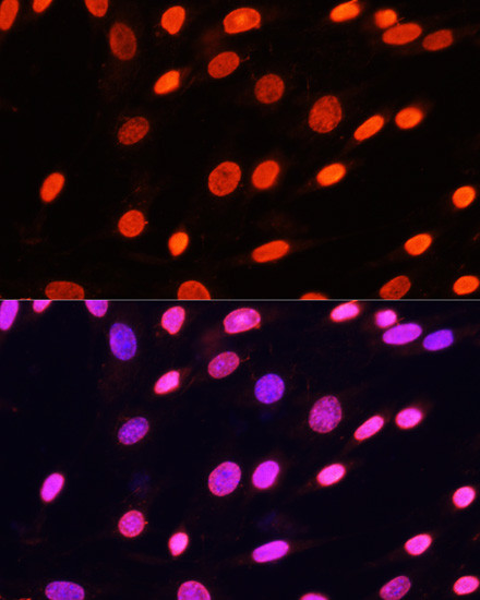 Di-Methyl-Lysine Antibody in Immunocytochemistry (ICC/IF)