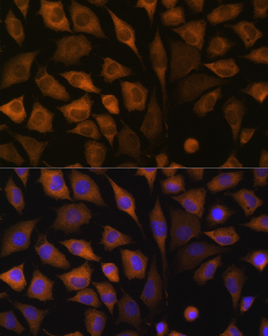 SND1 Antibody in Immunocytochemistry (ICC/IF)