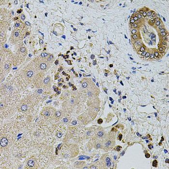KTN1 Antibody in Immunohistochemistry (Paraffin) (IHC (P))
