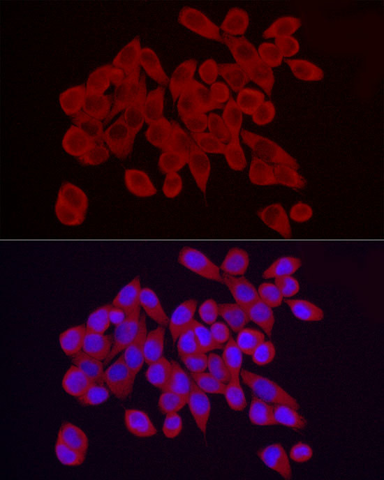 RPS10 Antibody in Immunocytochemistry (ICC/IF)
