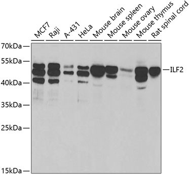ILF2 Antibody in Western Blot (WB)