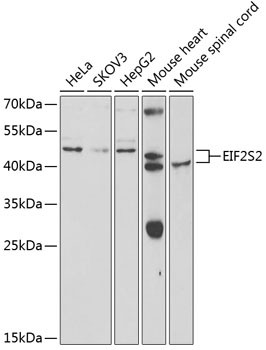 eIF2 beta Antibody in Western Blot (WB)