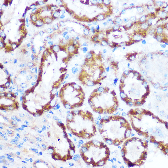 MAP4 Antibody in Immunohistochemistry (Paraffin) (IHC (P))