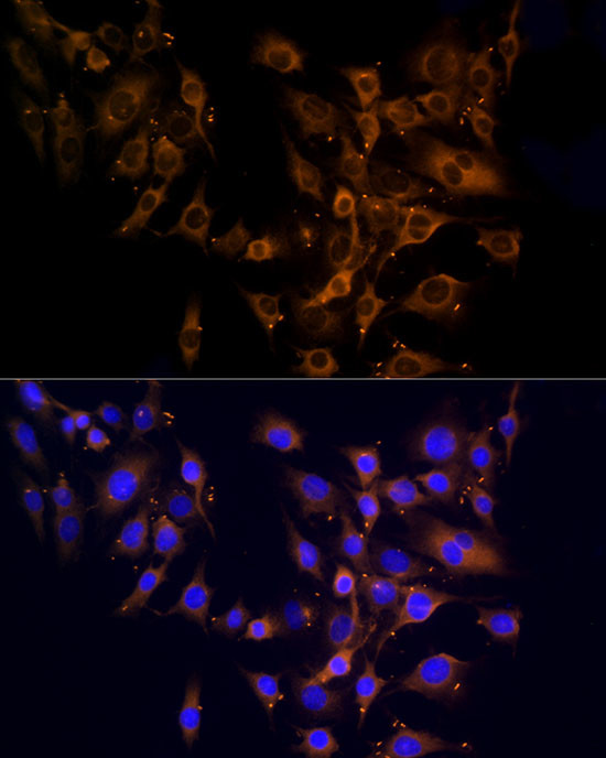 RPL10A Antibody in Immunocytochemistry (ICC/IF)