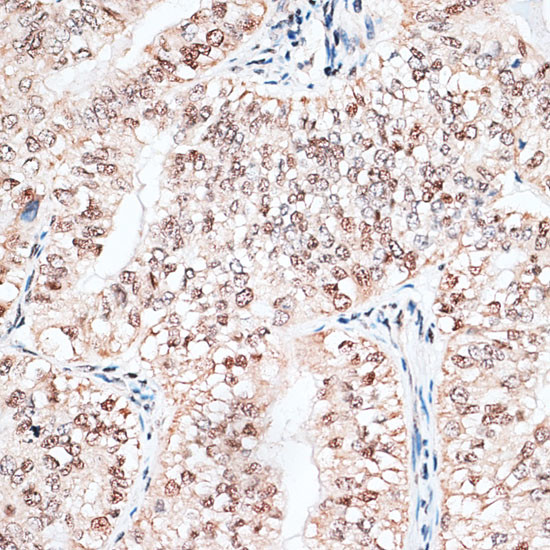 RBM3 Antibody in Immunohistochemistry (Paraffin) (IHC (P))
