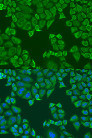 PABPC4 Antibody in Immunocytochemistry (ICC/IF)