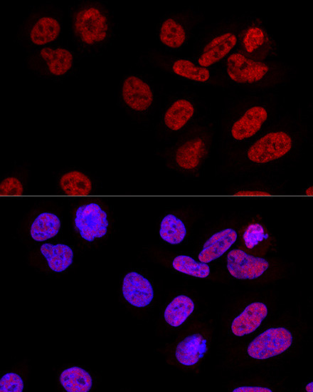 CPSF6 Antibody in Immunocytochemistry (ICC/IF)