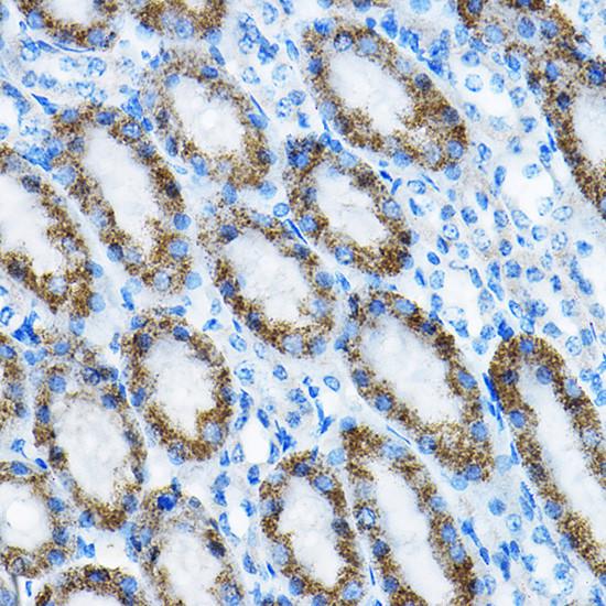 MRPL13 Antibody in Immunohistochemistry (Paraffin) (IHC (P))