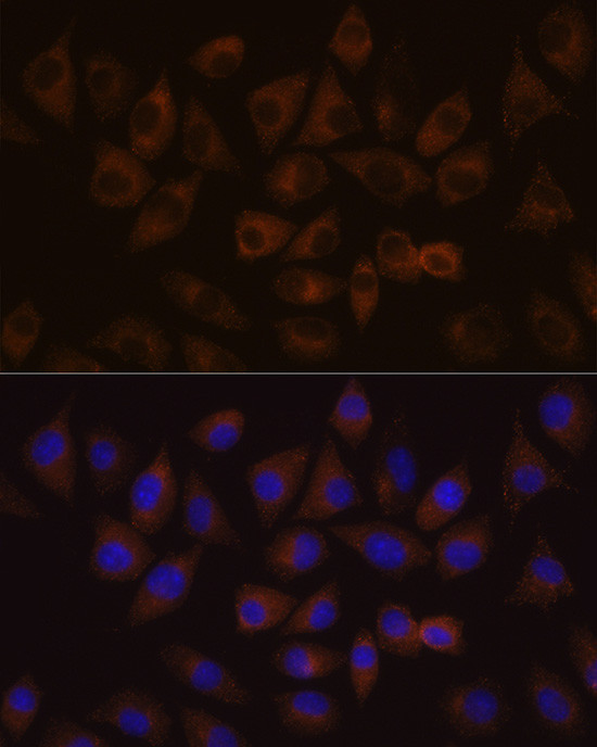 HDLBP Antibody in Immunocytochemistry (ICC/IF)