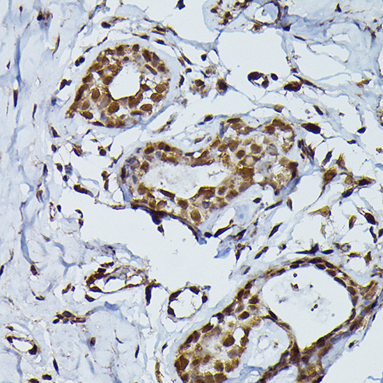 PRPF4 Antibody in Immunohistochemistry (Paraffin) (IHC (P))