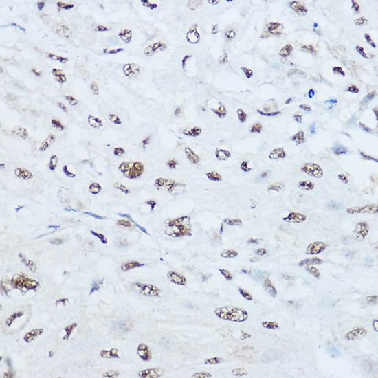 SRRM1 Antibody in Immunohistochemistry (Paraffin) (IHC (P))