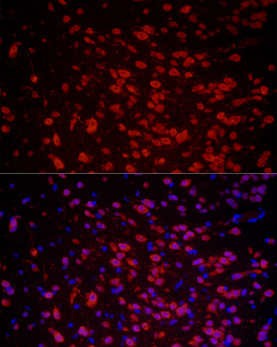 HuC Antibody in Immunocytochemistry (ICC/IF)