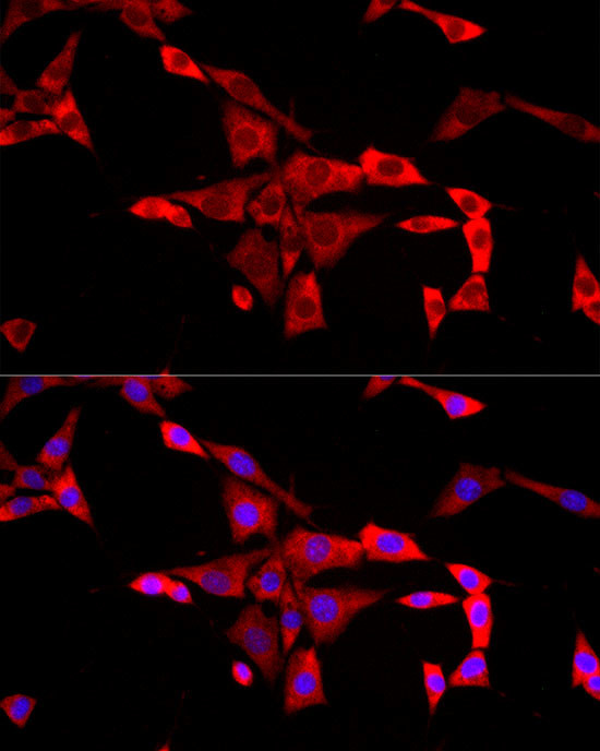 FMRP Antibody in Immunocytochemistry (ICC/IF)