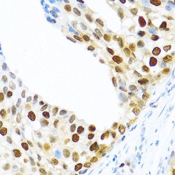 KHDRBS2 Antibody in Immunohistochemistry (Paraffin) (IHC (P))