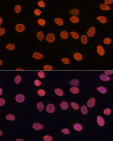 TADA3L Antibody in Immunocytochemistry (ICC/IF)