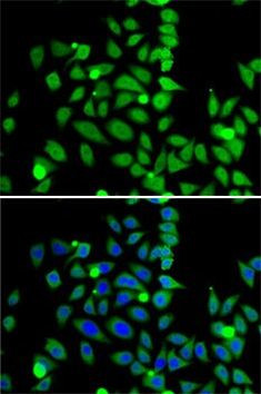 Histone H3 Antibody in Immunocytochemistry (ICC/IF)