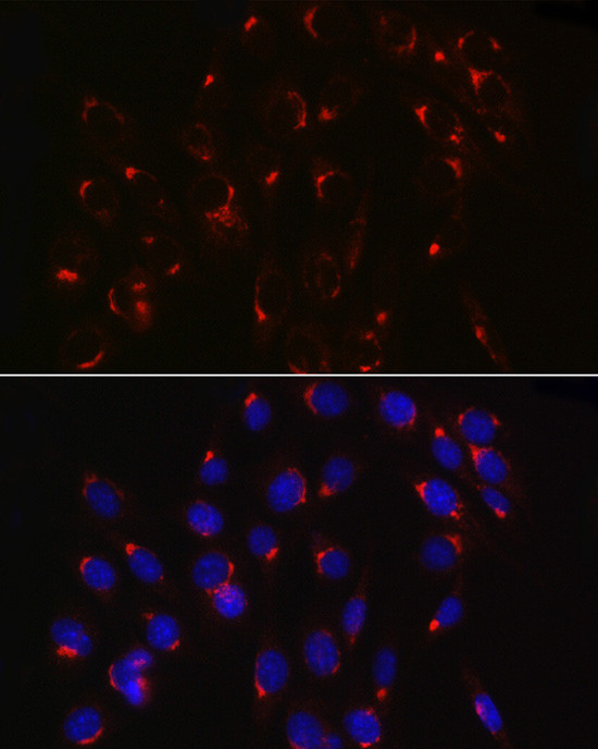 COPB2 Antibody in Immunocytochemistry (ICC/IF)