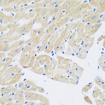 TGM5 Antibody in Immunohistochemistry (Paraffin) (IHC (P))