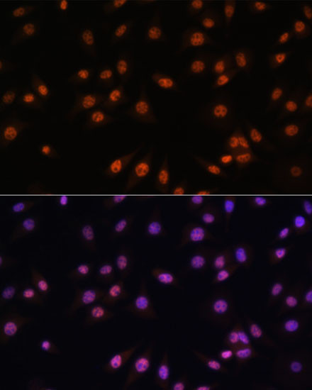 EFTUD2 Antibody in Immunocytochemistry (ICC/IF)