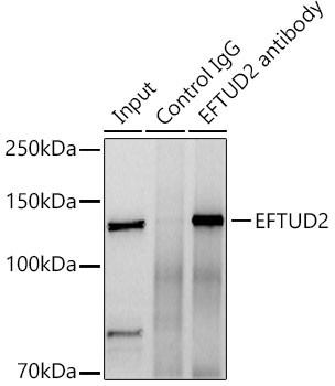 EFTUD2 Antibody in Immunoprecipitation (IP)