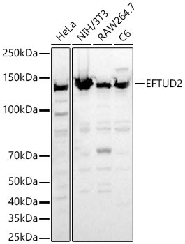 EFTUD2 Antibody in Western Blot (WB)