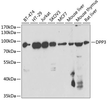 DPP3 Antibody in Western Blot (WB)