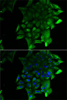 SLA/LP Antibody in Immunocytochemistry (ICC/IF)