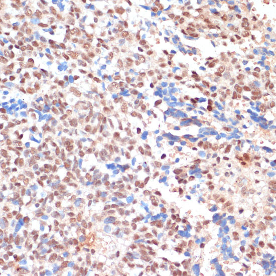 NAA20 Antibody in Immunohistochemistry (Paraffin) (IHC (P))
