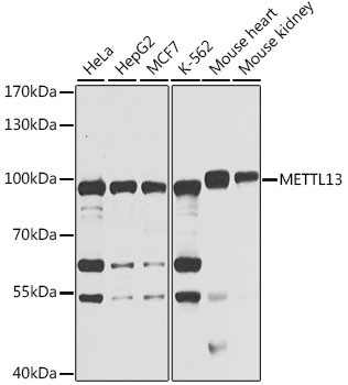 METTL13 Antibody in Western Blot (WB)