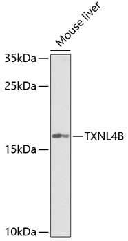 TXNL4B Antibody in Western Blot (WB)
