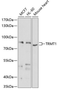 TRMT1 Antibody in Western Blot (WB)