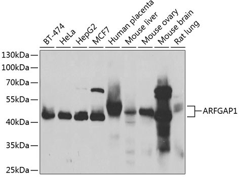 ARFGAP1 Antibody in Western Blot (WB)