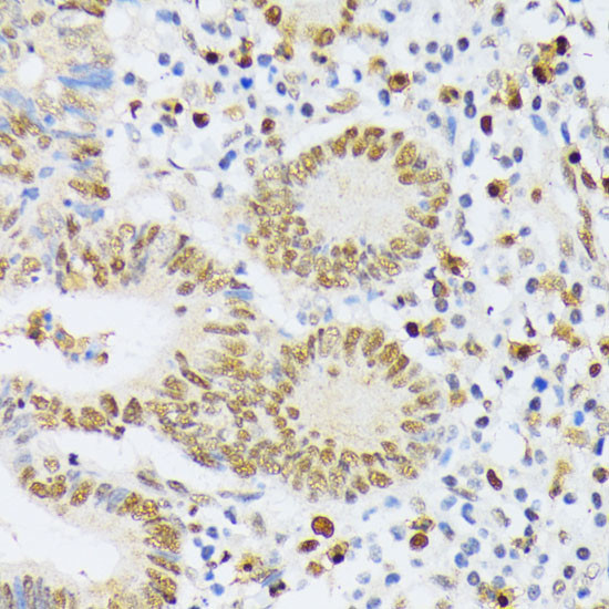ELAC2 Antibody in Immunohistochemistry (Paraffin) (IHC (P))