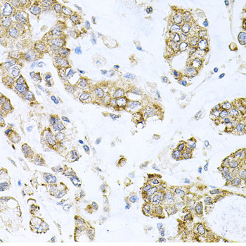 ALKBH8 Antibody in Immunohistochemistry (Paraffin) (IHC (P))