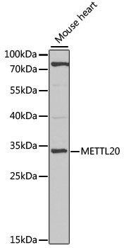METTL20 Antibody in Western Blot (WB)