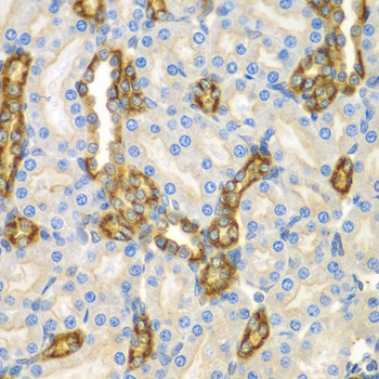 CNPY3 Antibody in Immunohistochemistry (Paraffin) (IHC (P))