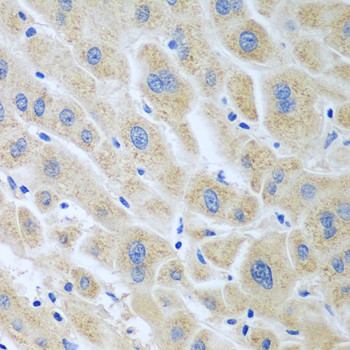 Flavin reductase Antibody in Immunohistochemistry (Paraffin) (IHC (P))