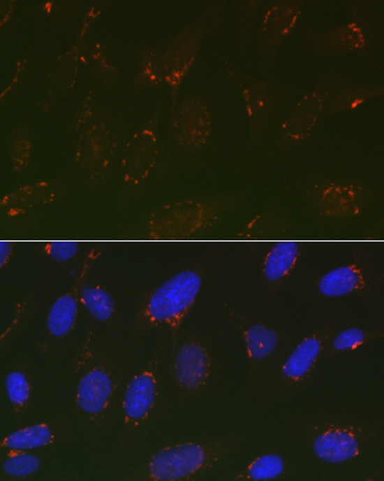 GOLPH2 Antibody in Immunocytochemistry (ICC/IF)