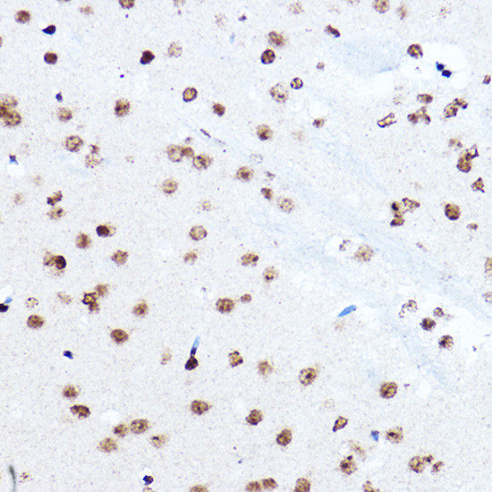 SETD5 Antibody in Immunohistochemistry (Paraffin) (IHC (P))