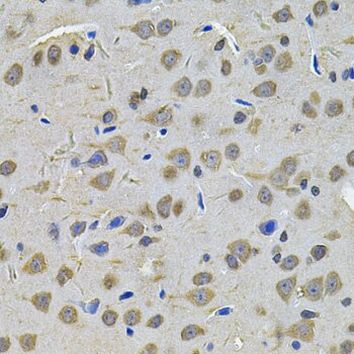 TGM1 Antibody in Immunohistochemistry (Paraffin) (IHC (P))