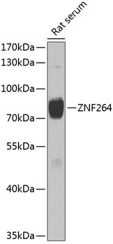 ZNF264 Antibody in Western Blot (WB)