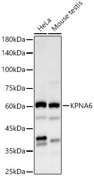 KPNA6 Antibody in Western Blot (WB)
