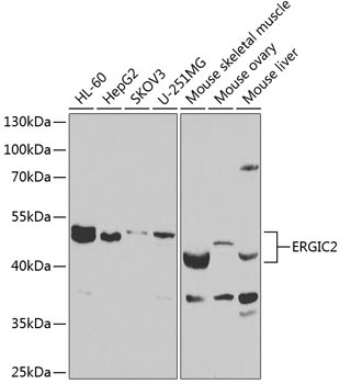 ERGIC2 Antibody in Western Blot (WB)