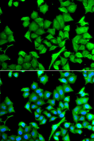 NAT13 Antibody in Immunocytochemistry (ICC/IF)